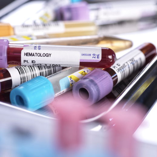 drug and Alcohol screening